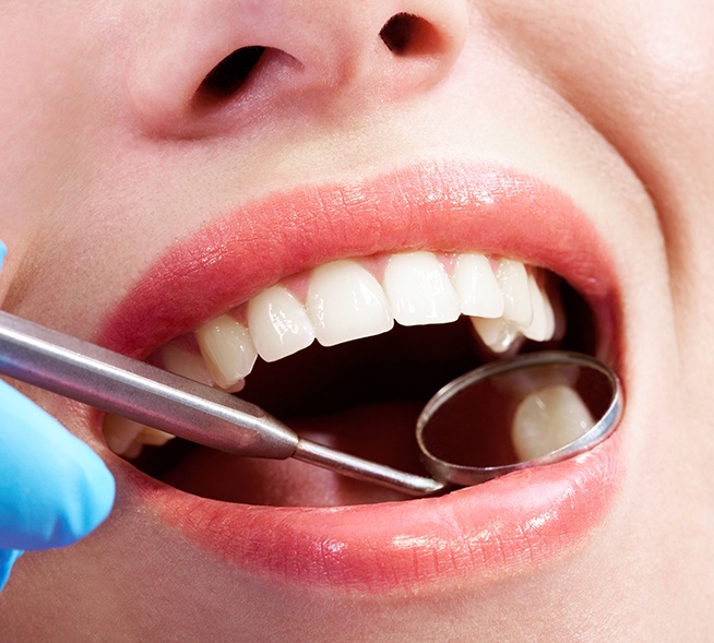 Dentist examining patient's tooth-colored filling