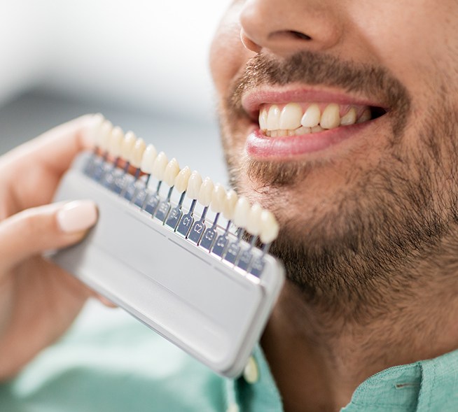 Smile compared to porcelain veneer shades