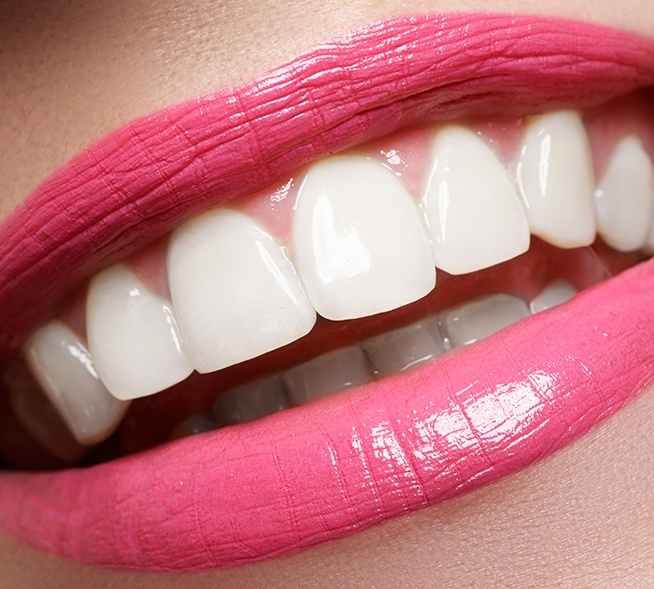 Closeup of smile with metal free dental restorations