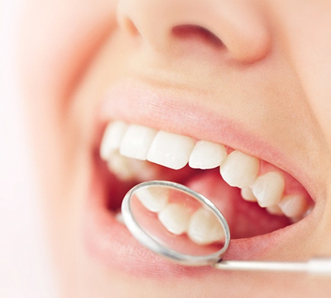 Closeup of beautiful smile with dental crowns in Tyler