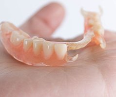 an example of partial dentures in Mt. Dora