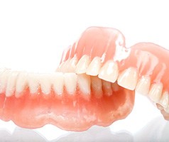 examples of full dentures in Mt. Dora