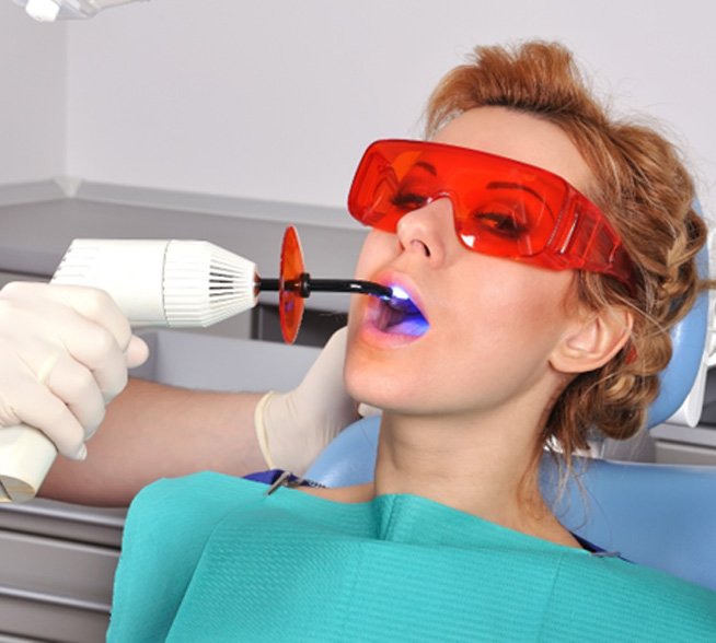 Dentist hardening filling with special light
