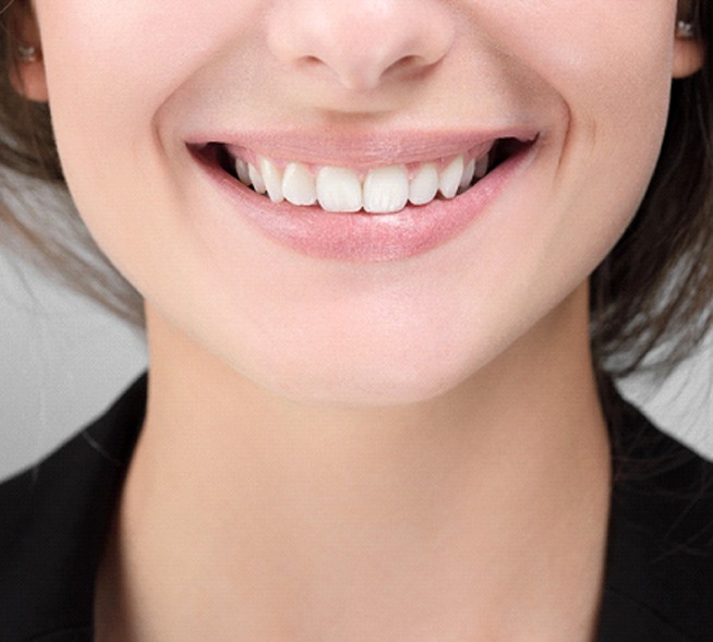 woman smiling before teeth whitening in Mt. Dora