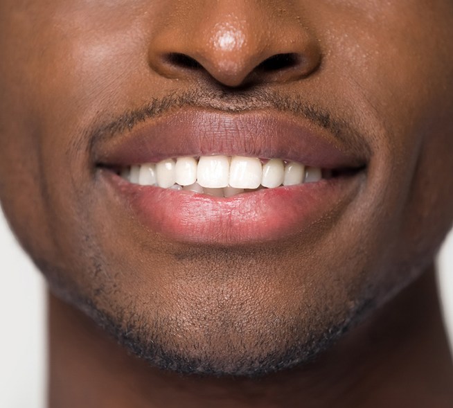 Smiling man with porcelain veneers in Mt. Dora