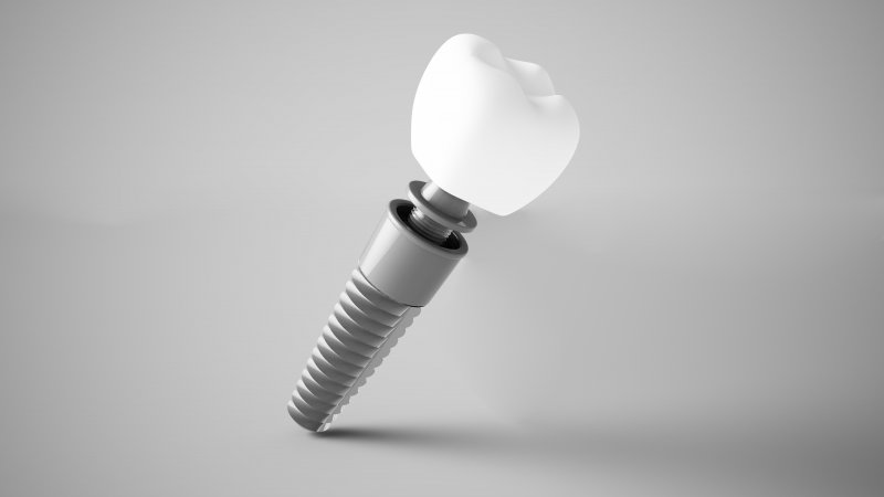 a digital image of a single dental implant in Mt. Dora